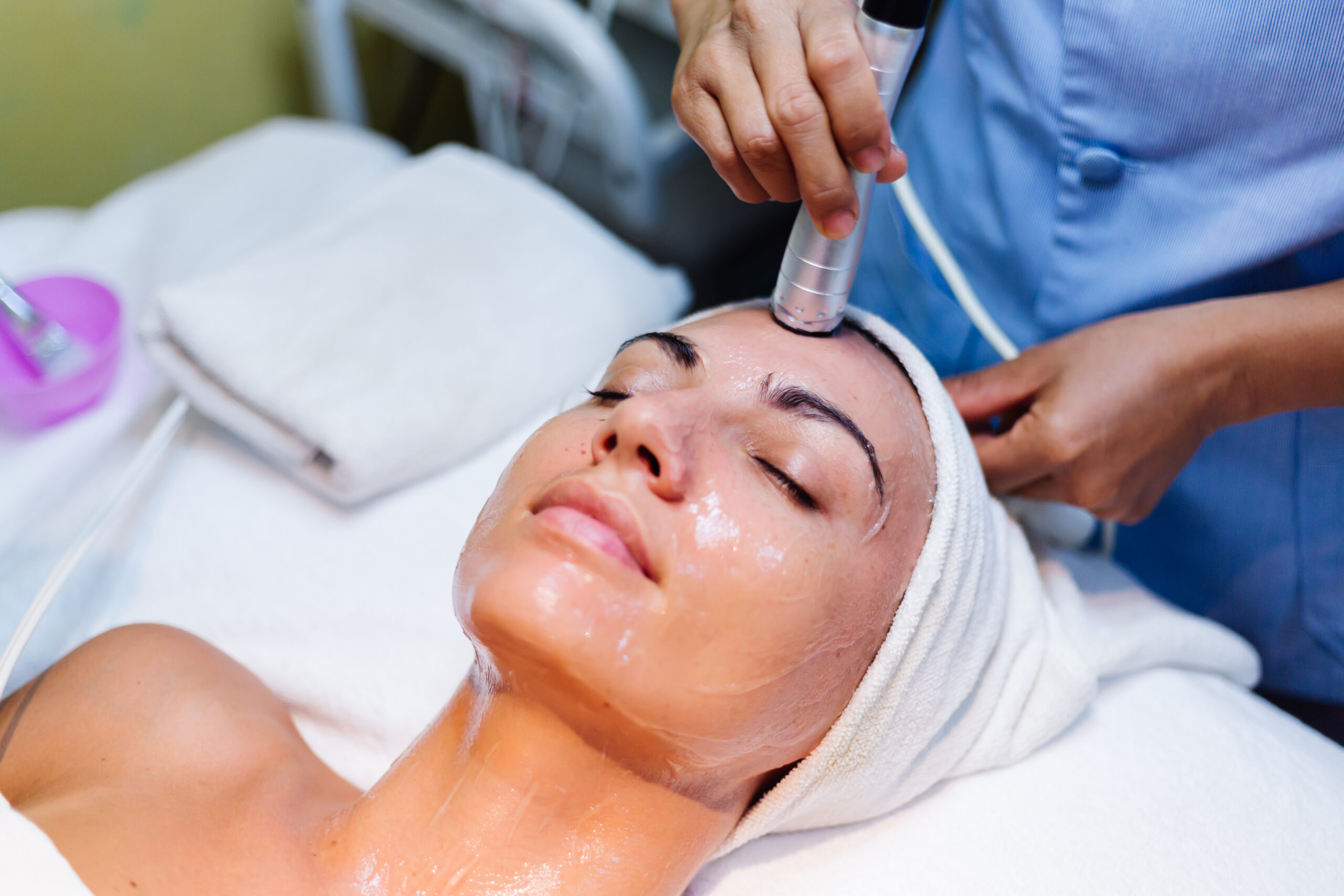 Micro needling service women picture