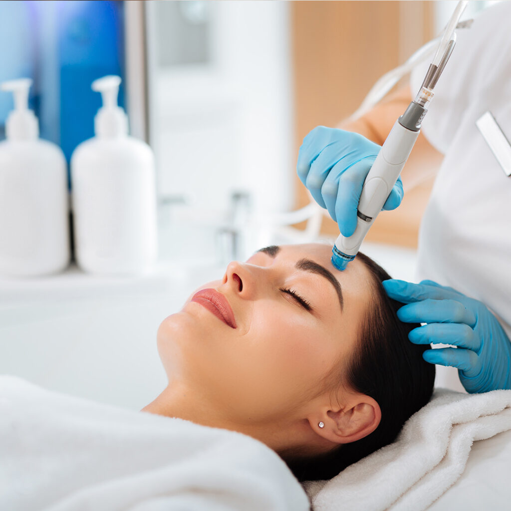 What is micro needling