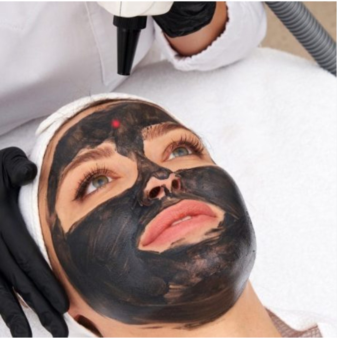 Hollywood_laser_Carbon_Peel_treatment-image