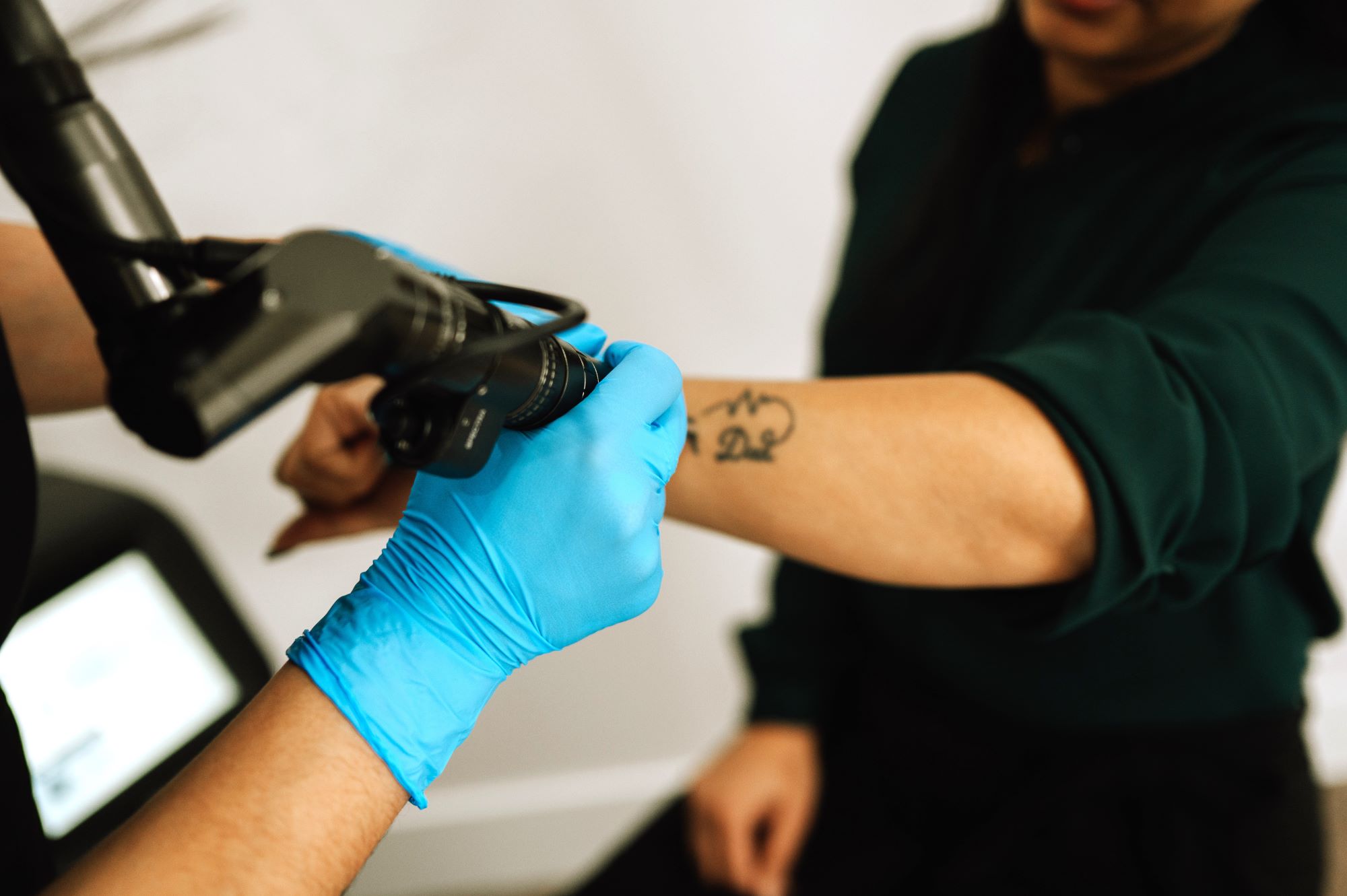 Laser_Tattoo_Removal_treatment_at_Bombshell_Aesthetics_Image