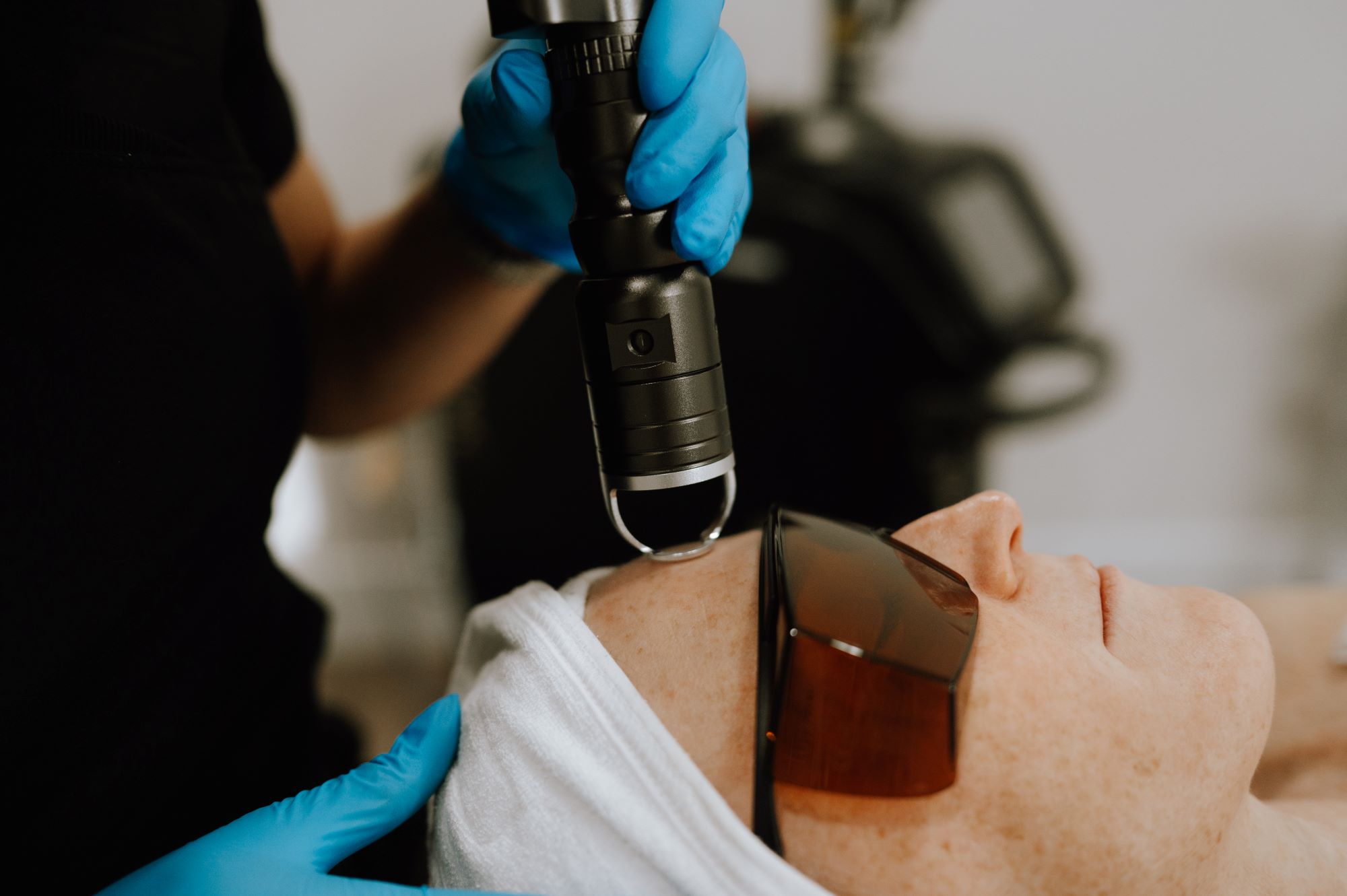 laser_skin_rejuvenation_treatment_Image