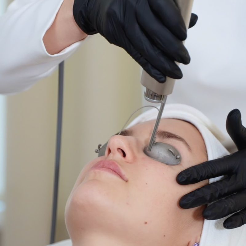 Laser_Skin_Rejuvenation_Image_Portrait