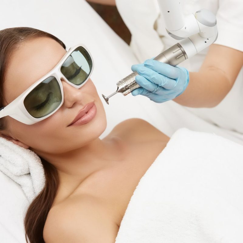 Laser_Toning_Treatment_Image
